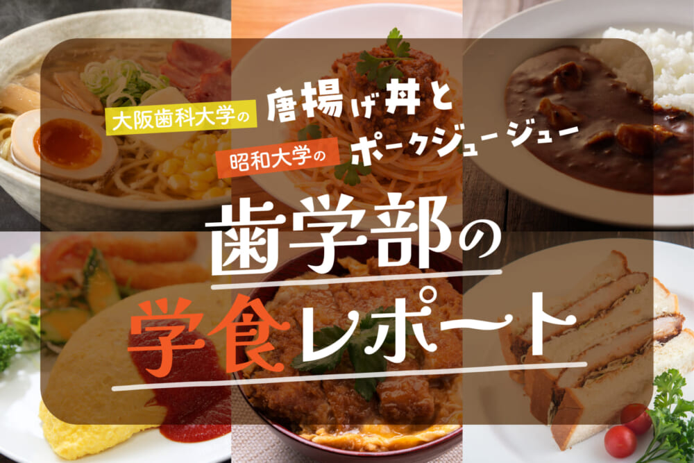 大阪歯科大学の「唐揚げ丼」と昭和大学の「ポークジュージュー」／歯学部の学食レポート#1